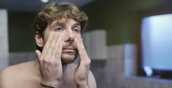 Dermal filler treatment for smoother skin