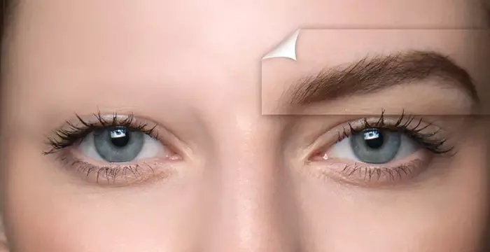 Understanding eyebrow transplants