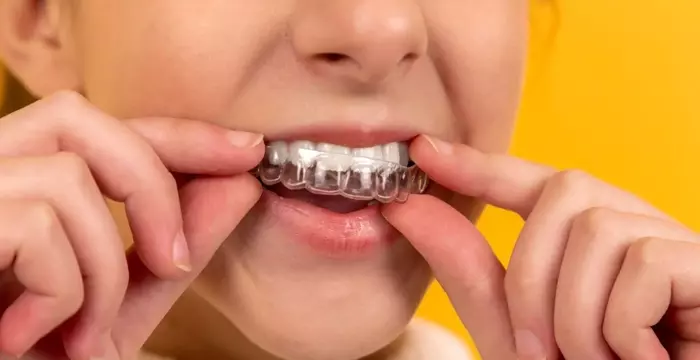 Choosing the Right Dental Braces: A Guide for All Ages